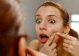 How to Find the Best Pimple Spot Treatment for Your Skin Type?