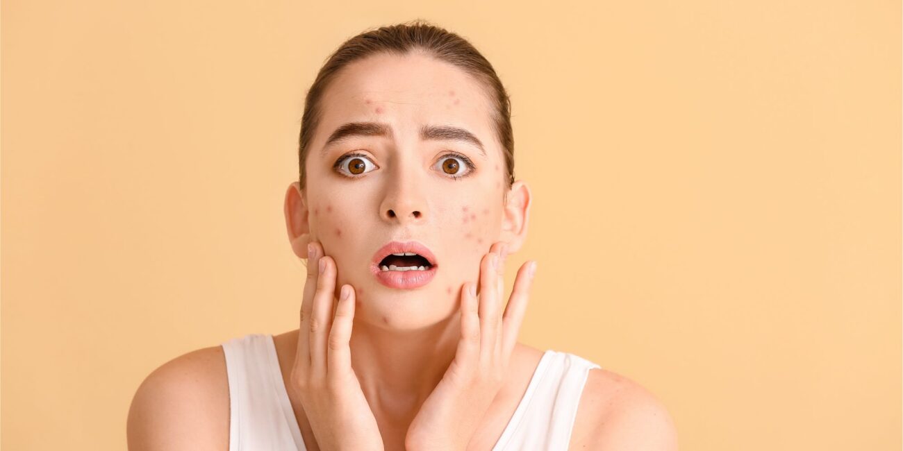 Is Acne Laser Treatment Worth the Price?