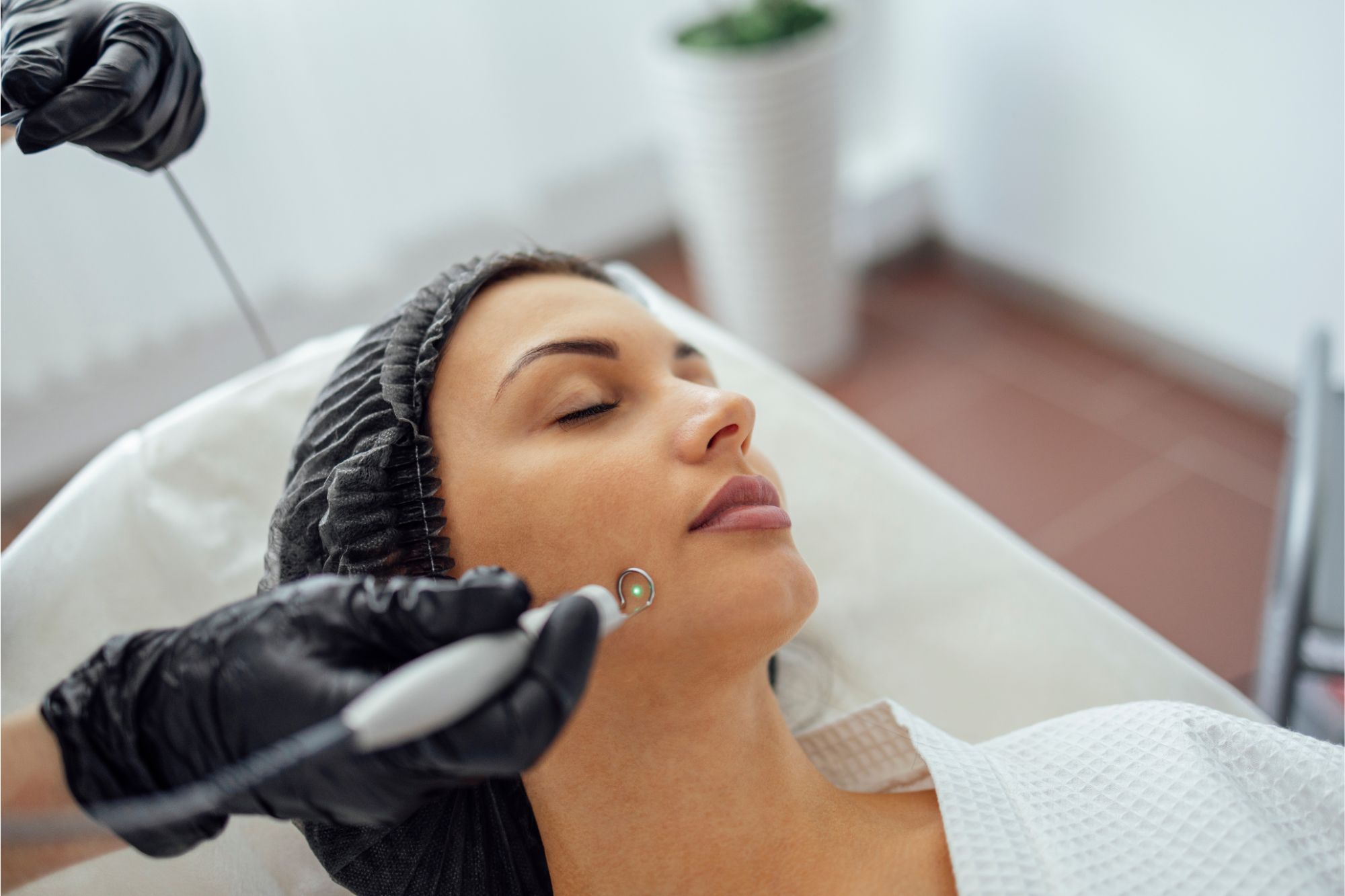 Acne Scar Removal Treatment Price Malaysia