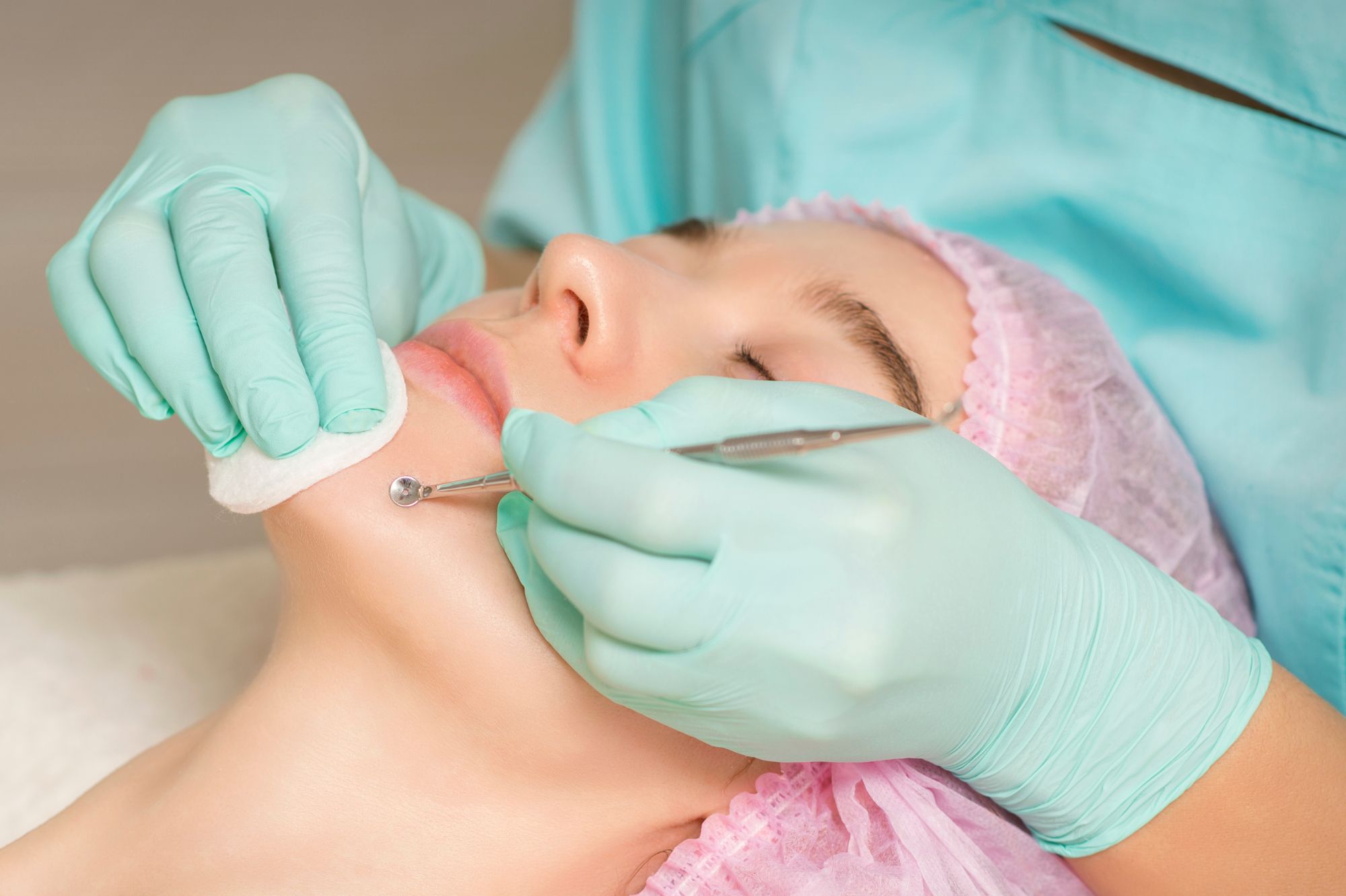 Best Acne Spot Treatment Price Malaysia