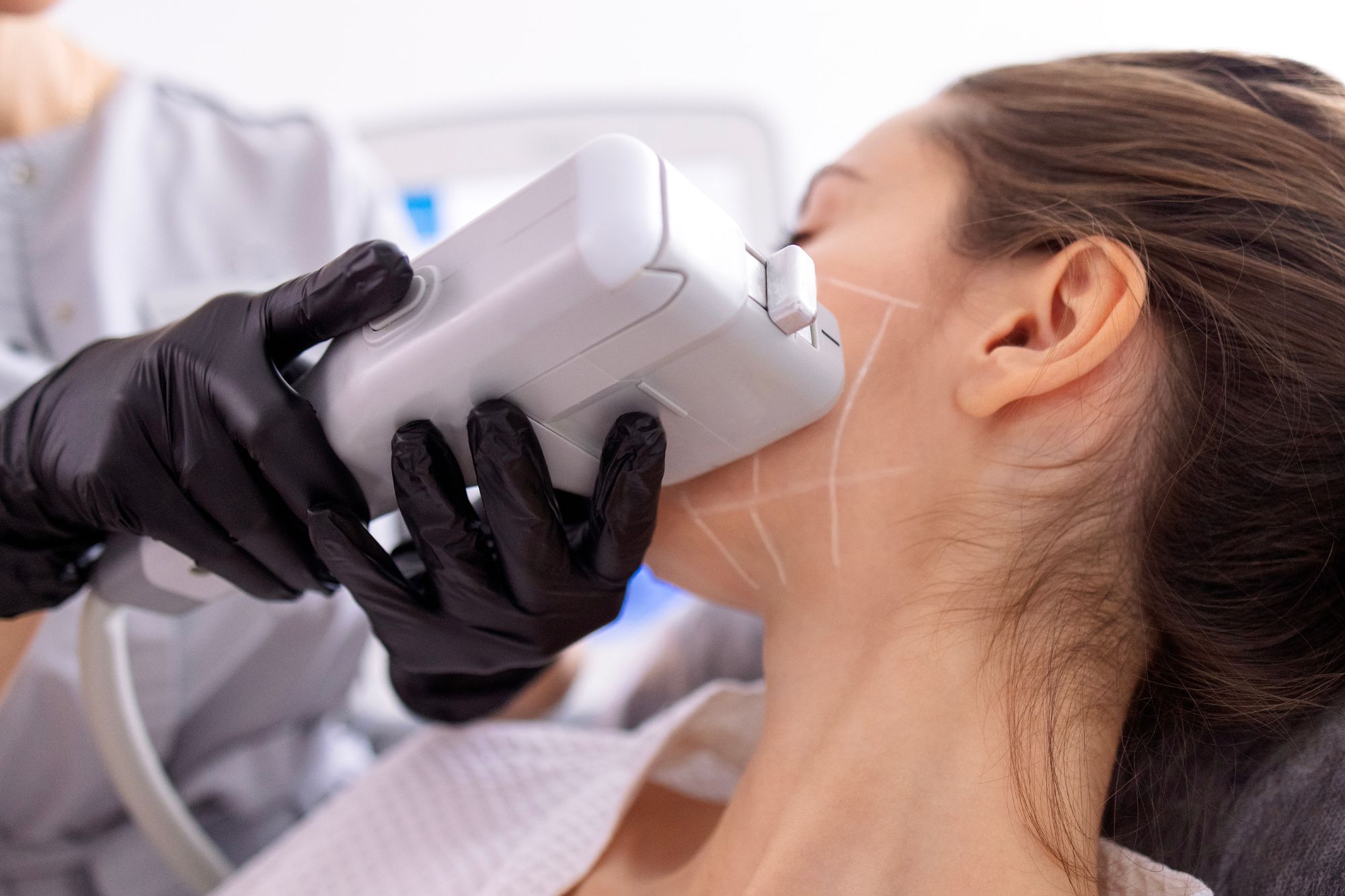HIFU Facial Price Malaysia