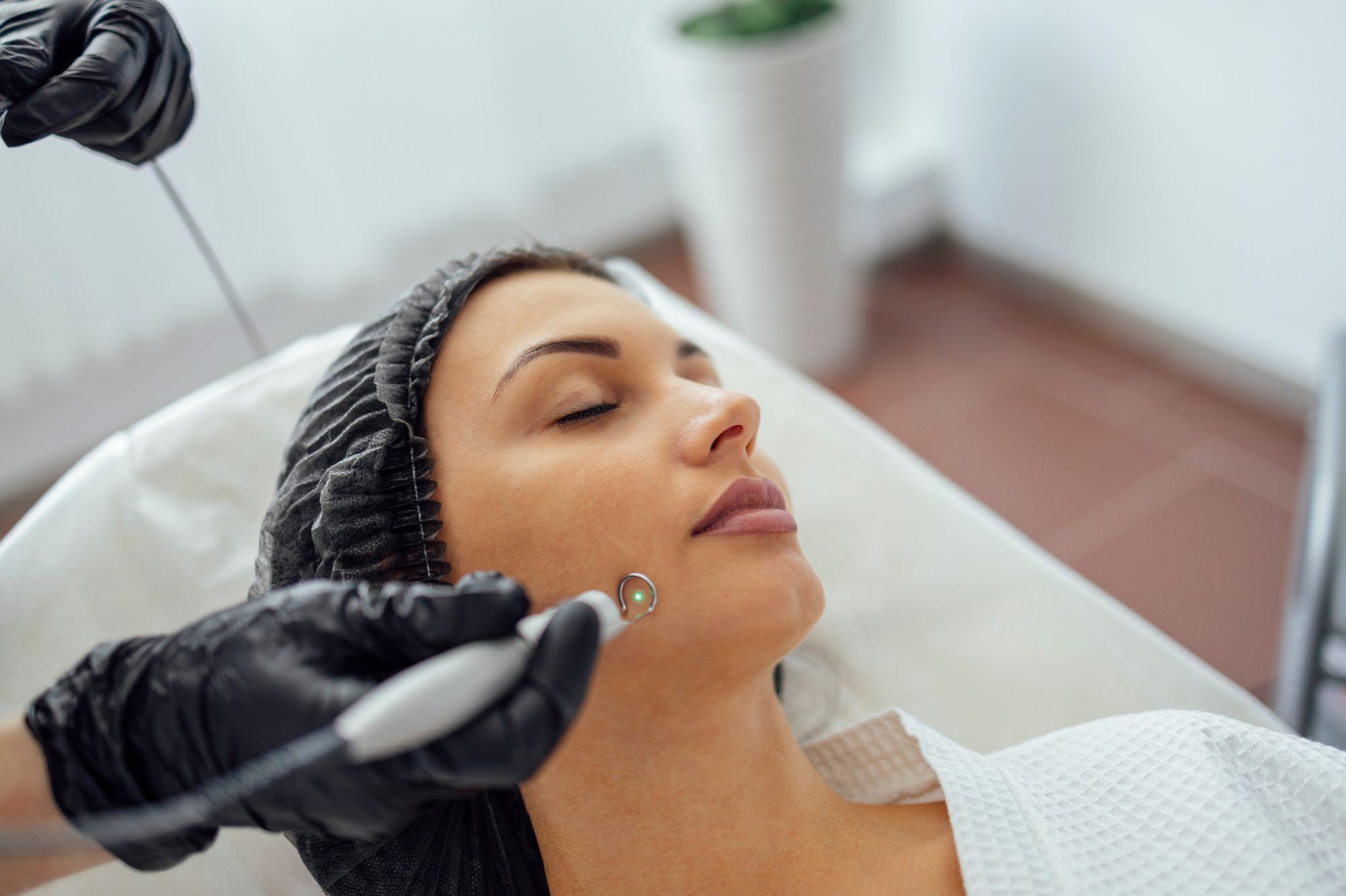 Pimple Scar Removal Price Malaysia