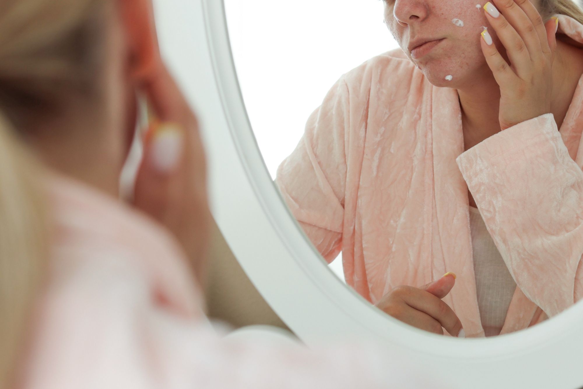 Professional Acne Treatment vs Home Remedies