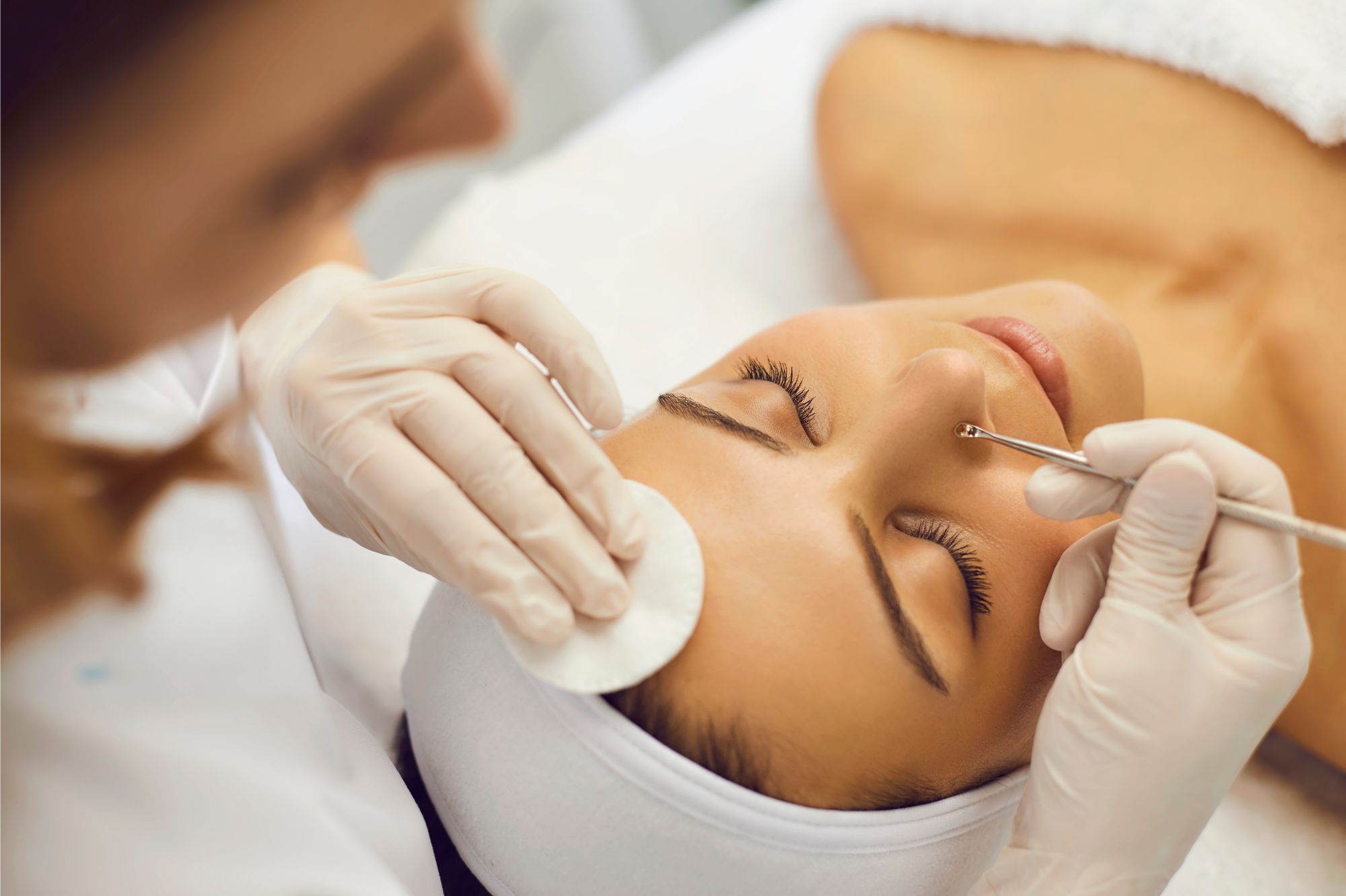 Acne Removal Treatment Johor Bahru: Choosing the Right Clinic